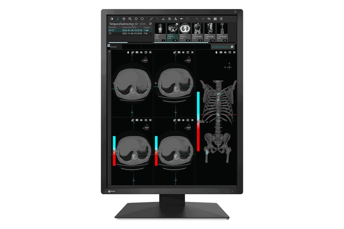 Eizo Mx-Series21.3in LCD LED Color Dicom Calib Blk Integ Front Sensor